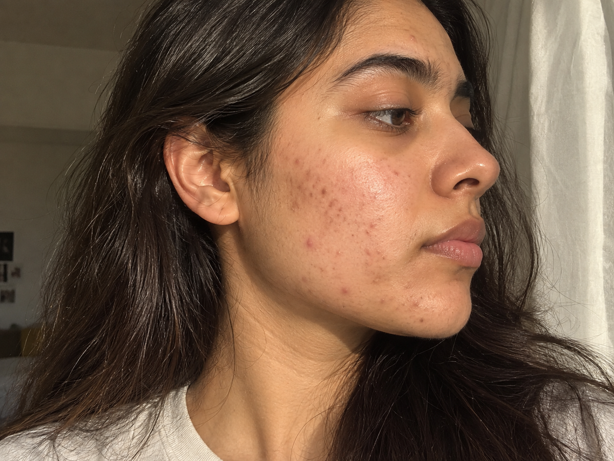 Skin with visible blemishes