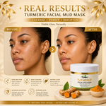 Britgerv Turmeric Clay Facial Mud Mask – Deep Cleansing & Pore Refining Face Mask for Smooth, Radiant Skin, 5.07 oz (150 g)