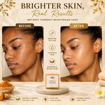 Britgerv Turmeric Brightening Face & Body Soap Bar - Deep Cleaning for Smooth, Radiant Skin, 3.5 0z (100 g)
